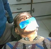 Dental dam.jpg